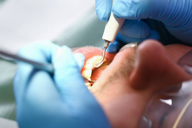 Best Urgent Care for Lost Fillings or Crowns in Goldthwaite, TX