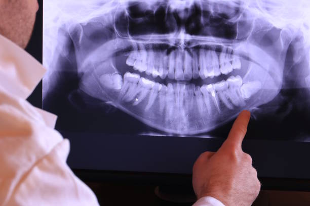 Best Emergency Tooth Extraction in Goldthwaite, TX