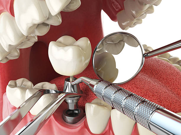 Best Same-Day Emergency Dental Services in Goldthwaite, TX