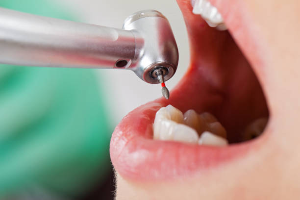 Best 24-Hour Emergency Dentist in Goldthwaite, TX